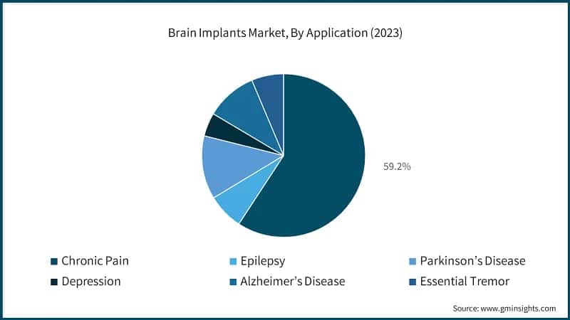 Brain Implants Market Share, By Application, 