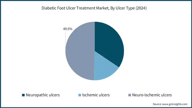 Diabetic Foot Ulcer Treatment Market, By Ulcer Type (2024)