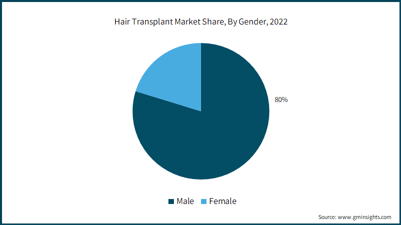 Hair Transplant Market Share, By Gender