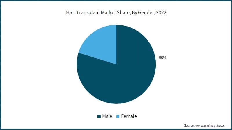 Hair Transplant Market Share, By Gender