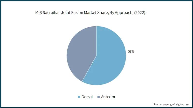 Global MIS Sacroiliac Joint Fusion Market Share, By Approach,
