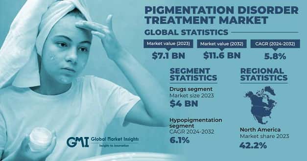 Pigmentation Disorder Treatment Market