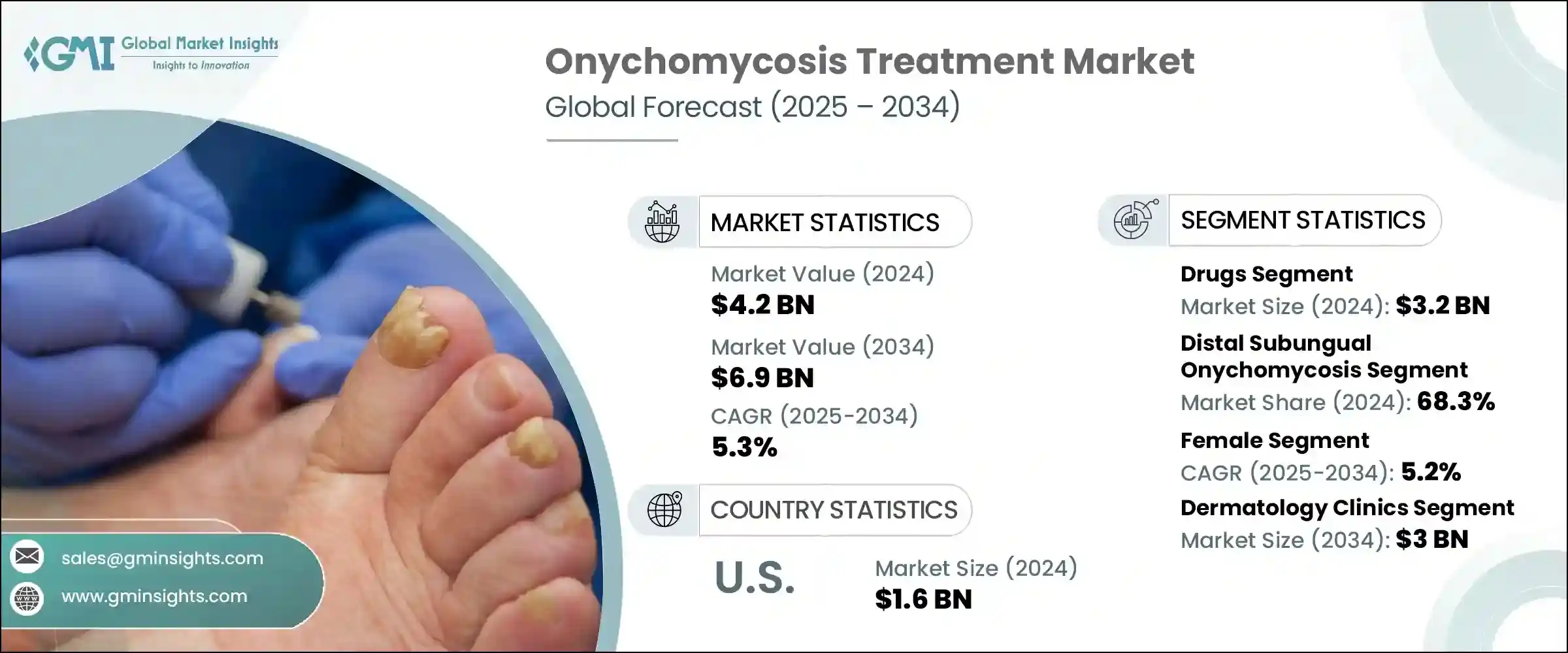 Onychomycosis Treatment Market 